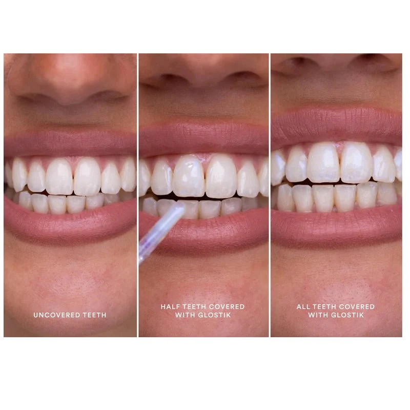 hismileglostik-instant-teeth-whitening-tooth-gloss-30ml-waha-lifestyle-kuwait-564991